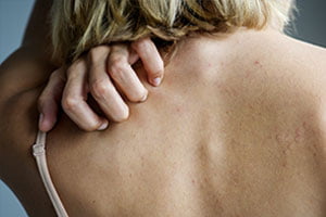 Skin Problems